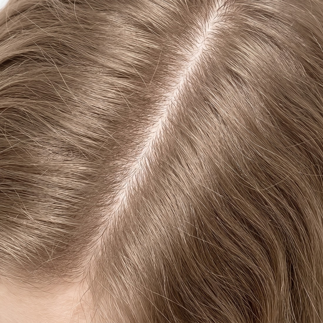 Gostota lasi&scaron;ča in rast las &mdash; Hair Energy Complex
